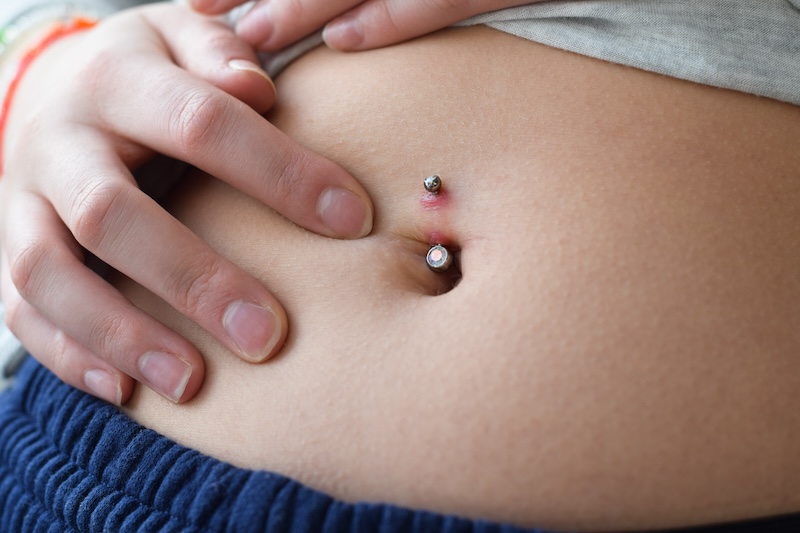 Bauch mit entzündetem Bauchnabelpiercing